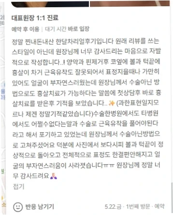 안면윤곽 수술 후 생긴 흉살과 근육유착으로 고통받던 환자가 수술 아닌 방법으로 치료받고 얼굴 라인이 개선되었다는 긍정적인 블로그 후기 화면.